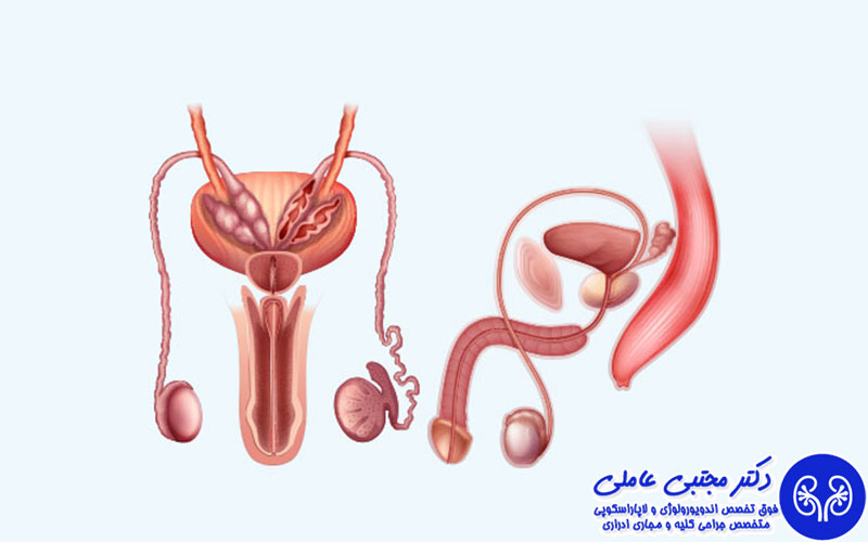جراحی بسته پروستات در تهران