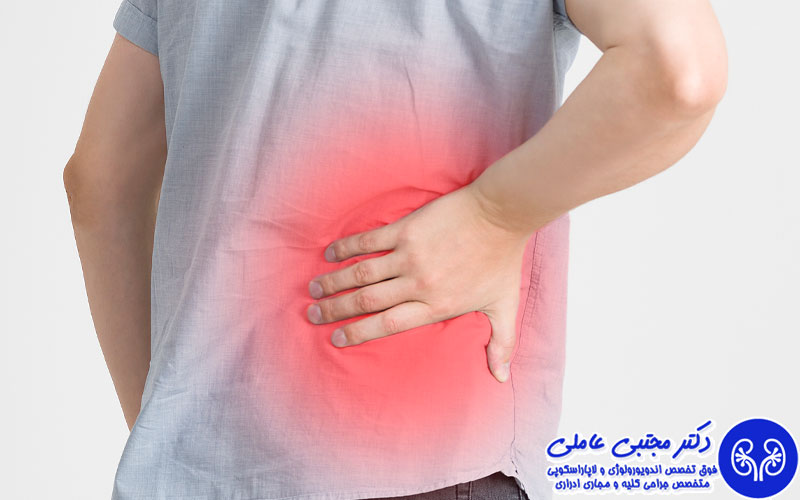 آیا تشکیل سنگ کلیه درد دارد