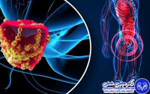 نیاز به بیهوشی در جراحی هولپ