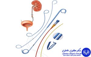 دبل جی کلیه چیست