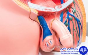 جراحی هیدروسلکتومی