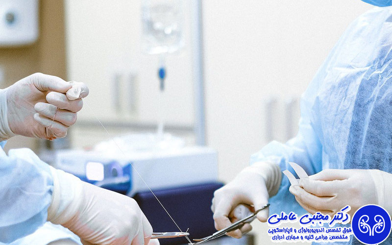 جراحی سنگ کلیه به روش ریرس