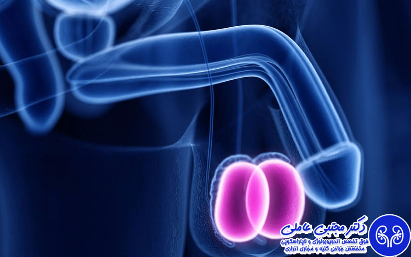 علل درد بیضه راست
