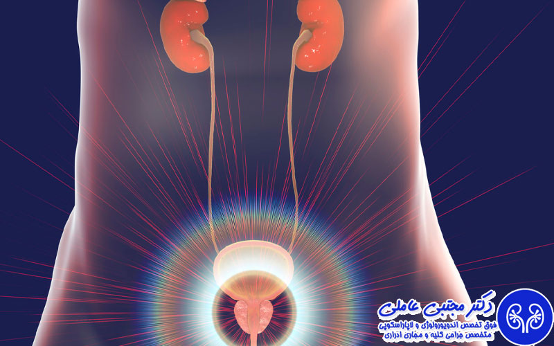 لیزر هولمیوم (HoLEP)