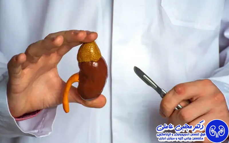 در جراحی ریرس، قطعات سنگ در کلیه پخش می شود
