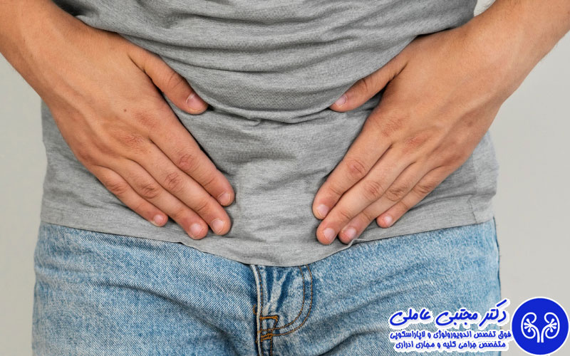 روش‌های نوین درمان واریکوسل