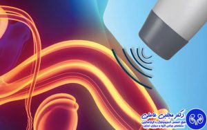 شاک ویو، راهکار نوین درمان پروستاتیت مزمن