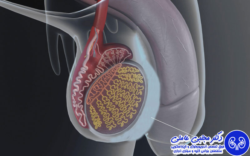 مقایسه درمان های غیرجراحی و جراحی هیدروسل