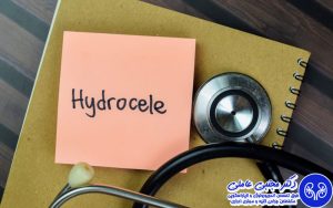 مقایسه درمان های غیرجراحی و جراحی هیدروسل