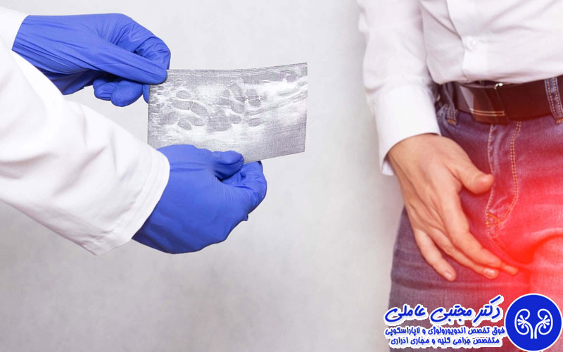 آیا واریکوسل دوباره عود می کند