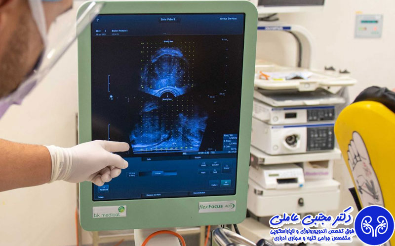 تاثیر سن و شرایط پزشکی بر انتخاب نوع جراحی پروستات