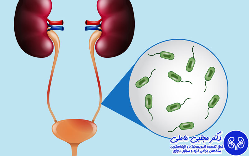 تشخیص عفونت های مزمن ادراری