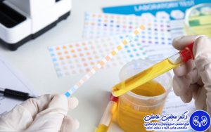 بررسی علت وجود خون در ادرار آقایان