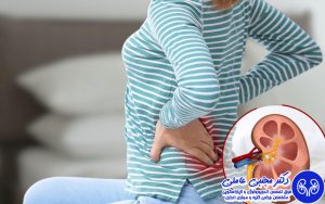 خروج سنگ کلیه بدون جراحی با اورتروسکوپی