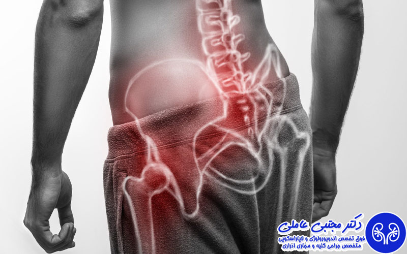 افتادگی بیضه