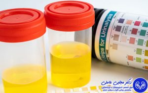 هر رنگ ادرار نشانه چیست