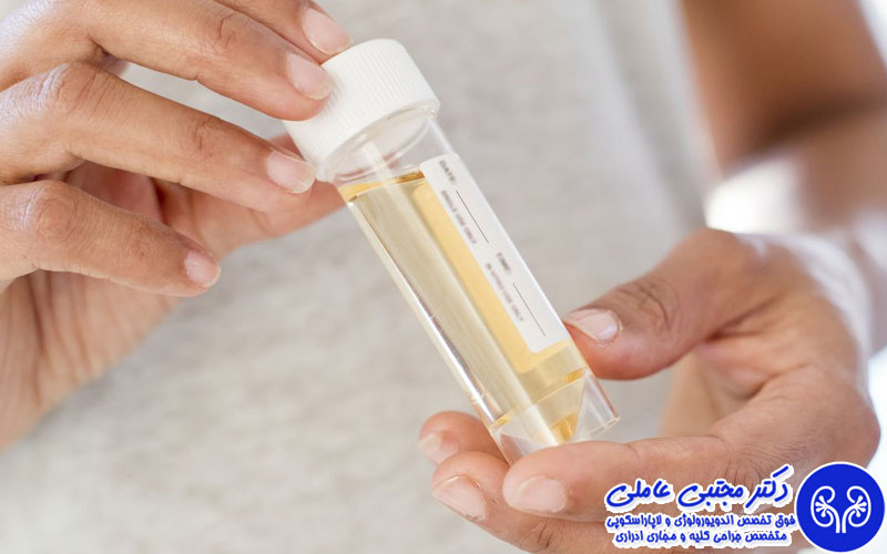 بوی ادرار نشانه چیست