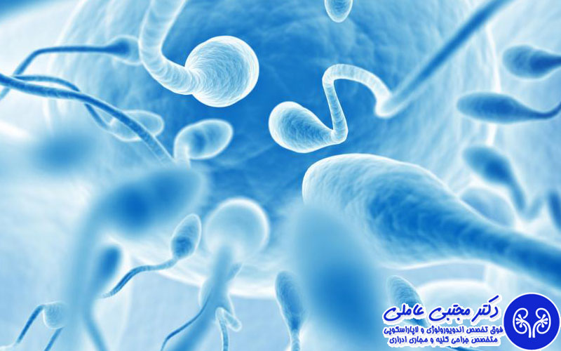 بررسی نتایج جراحی واریکوسل در افزایش شانس باروری