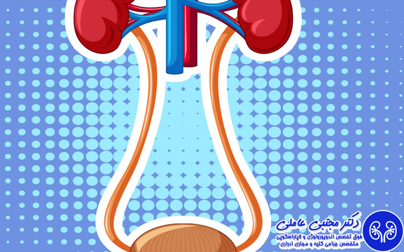 دیورتیکول مثانه