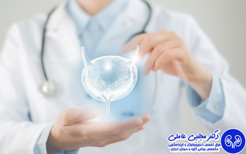 اسپاسم مثانه