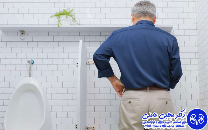 اسپاسم مثانه