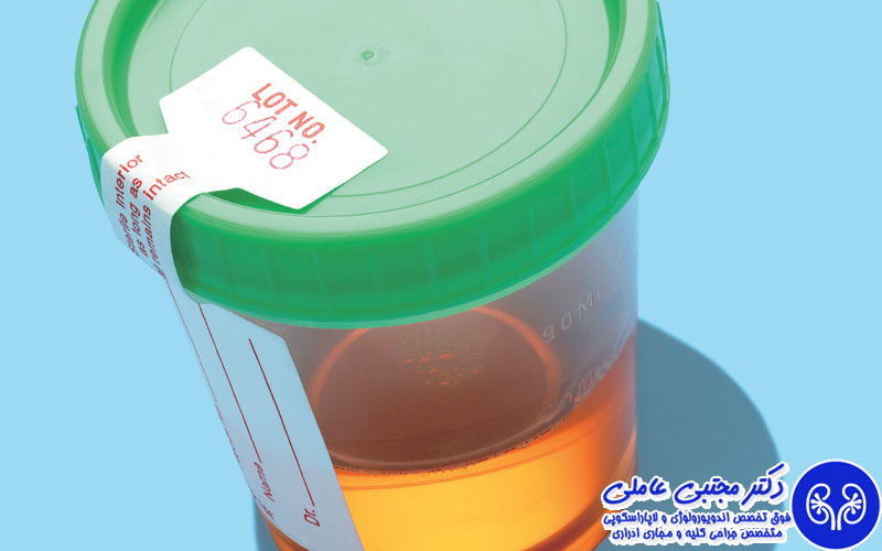 علت رنگ تیره ادرار