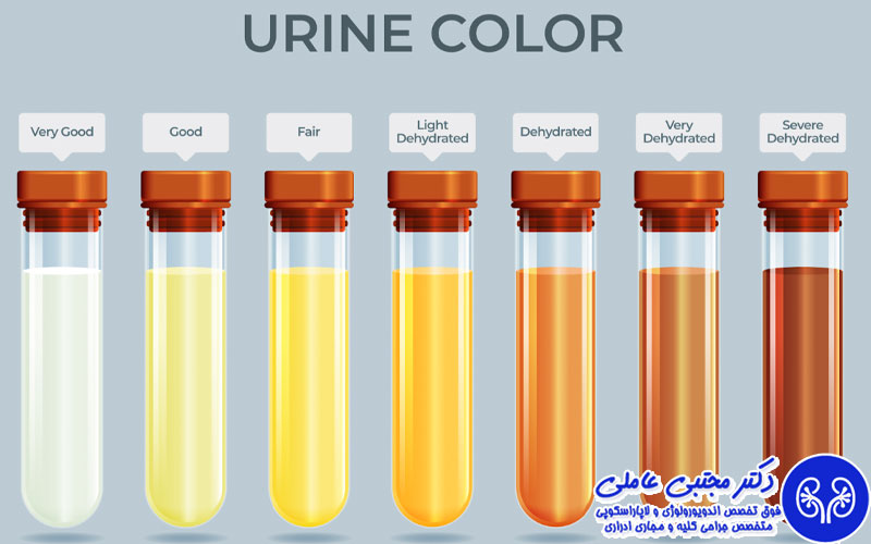 علت رنگ تیره ادرار