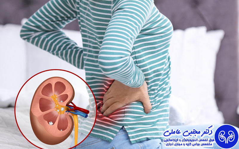 علت درد کلیه در صبحگاه