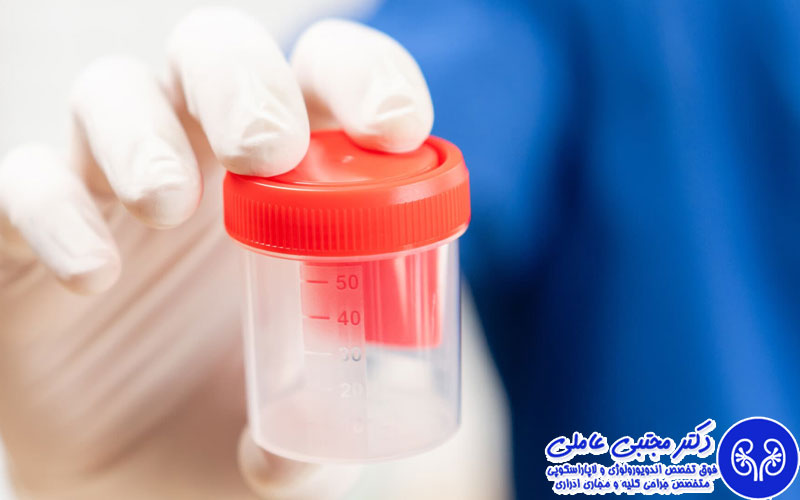 راهکارهای موثر برای افزایش کیفیت اسپرم