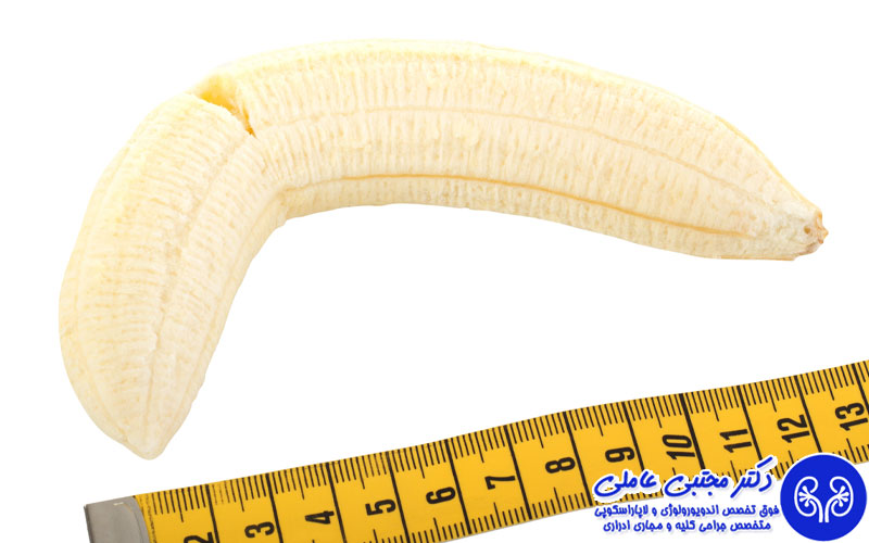 شکستگی آلت تناسلی