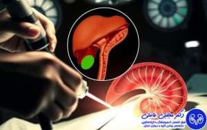 جراحی لیزری هولپ پروستات بزرگ