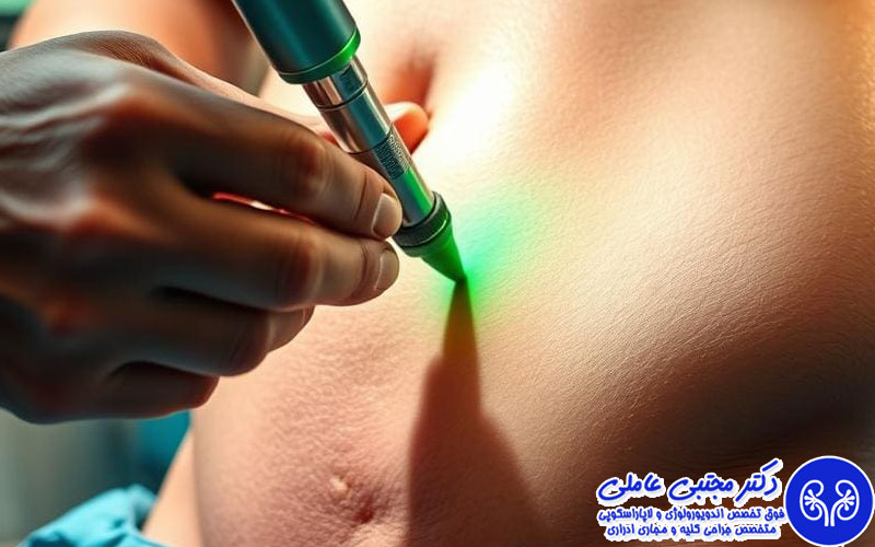 جراحی لیزری هولپ پروستات بزرگ