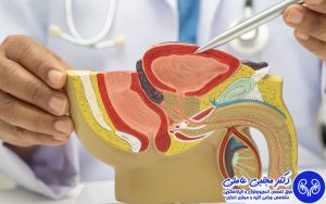 آیا جراحی لیزری پروستات برگشت‌پذیر است