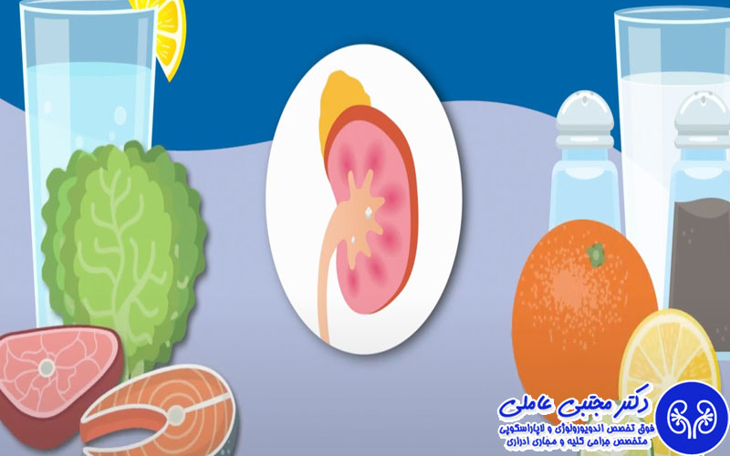  کاهش سنگ‌ سازی کلیه
