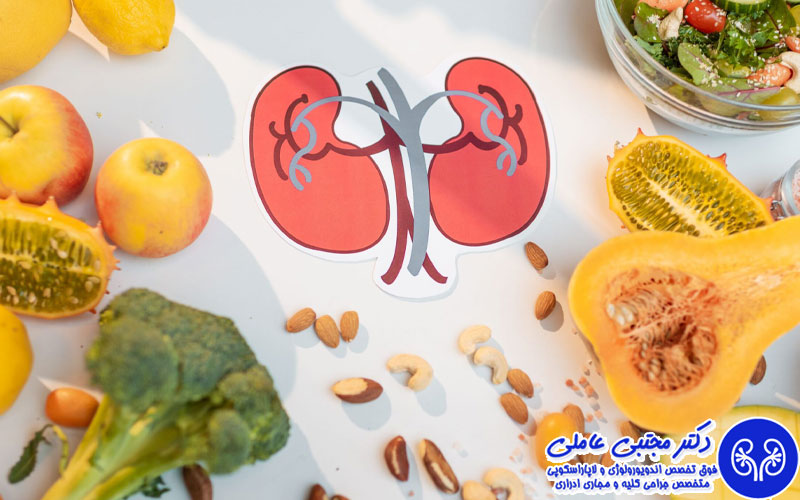  کاهش سنگ‌ سازی کلیه