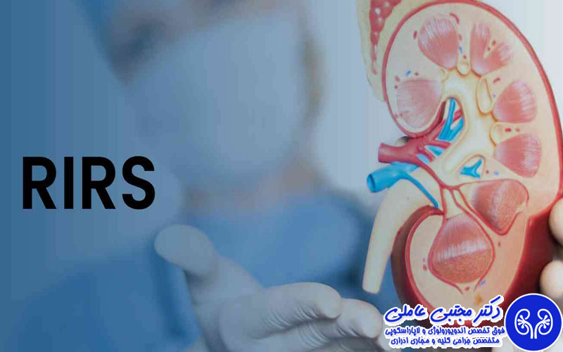 عمل RIRS چیست