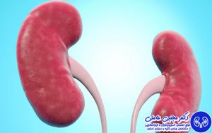علت درد کلیه پس از عمل چیست