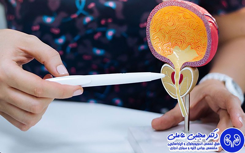 ۴ اشتباه خطرناک برای سلامت پروستات