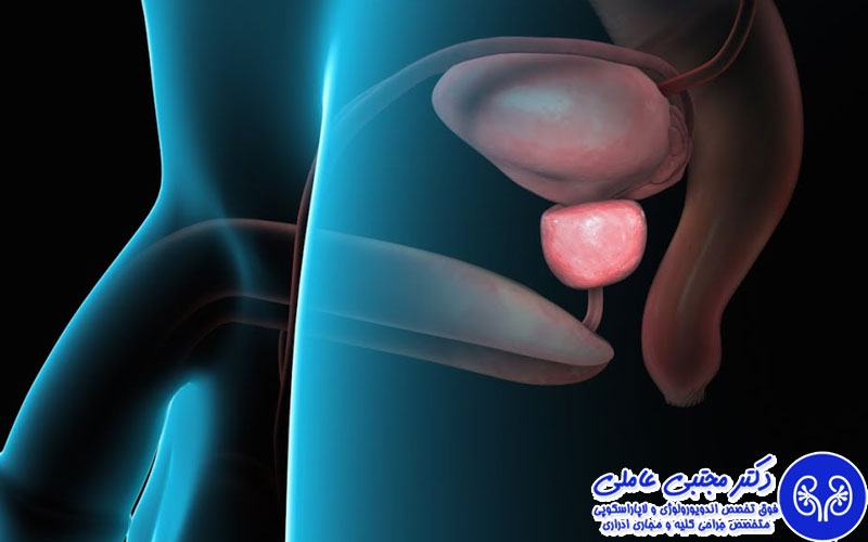 ۴ اشتباه خطرناک برای سلامت پروستات