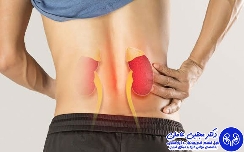 ۵ اشتباه رایج که به کلیهها آسیب میزند