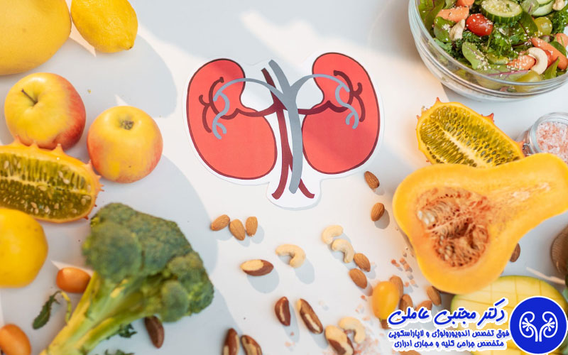 چگونه از سنگ کلیه پیشگیری کنیم