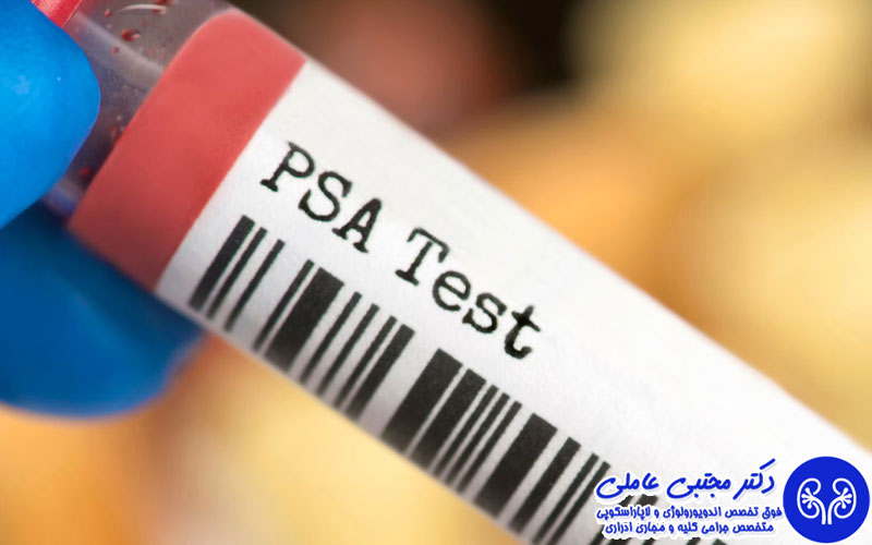 سوالات متداول درباره تولب پروستات